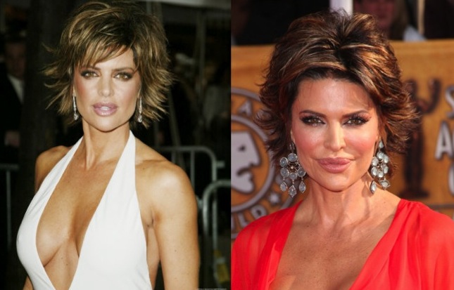 lisa rinna before and after plastic surgery